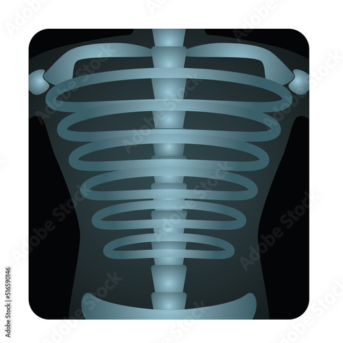 x-ray logo