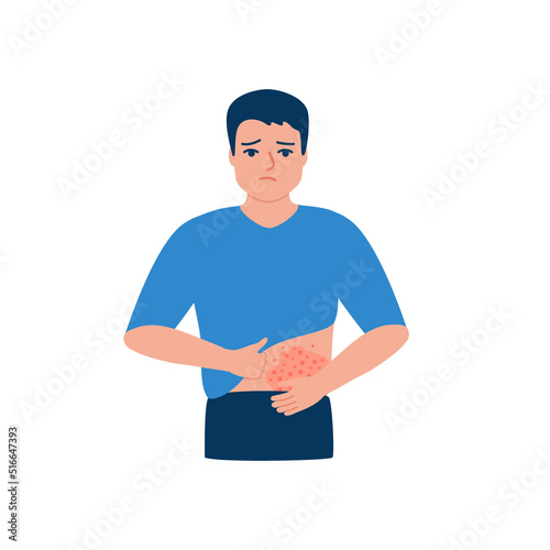 Man scratching body belly, rash, allergy, acne on skin. Male suffering from itchy skin, symptom disease. Vector illustration