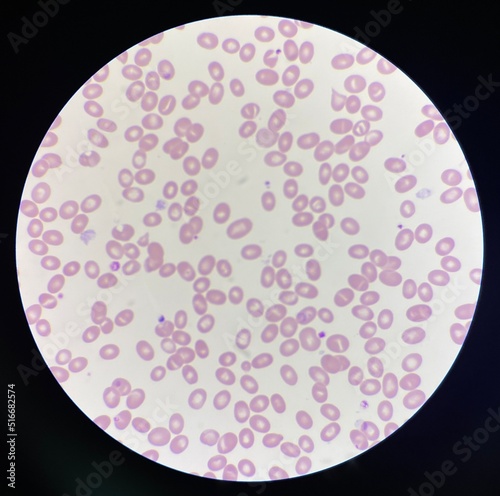 Red blood cells.