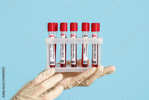 Hands of doctor with sample...