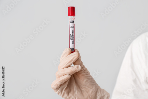Scientist with sample of monkeypox virus on light background, closeup photo