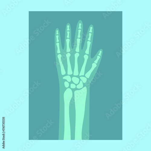 X-ray of a hand on a blue background
