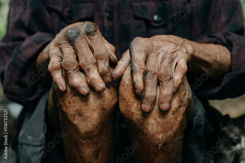 Fotografering Close up of male wrinkled hands, old man is wearing
