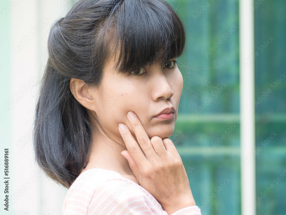 Acne woman. Authentic black hair, black eyes and skin tan asian Thailand. portrait beauty girl show face with little acne. for presentation foam face or lotion cream moisturizer skin care cosmetics. Acne woman. Authentic black hair, black eyes and skin tan asian Thailand. portrait beauty girl show face with little acne. for presentation foam face or lotion cream moisturizer skin care cosmetics.