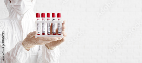 Scientist with samples of m...