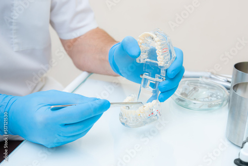 hands of a dentist in blue gloves close-up. dentist with tweezers shows defects on the acrylic model of the jaw