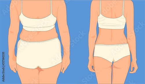 Figure befor and after from behind.