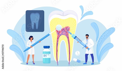 Dentists cleaning and treating big unhealthy tooth with caries cavity. Toothache. Stomatology, Dentistry concept. Doctors with professional instruments for check up and treatment. Dentist appointment photo