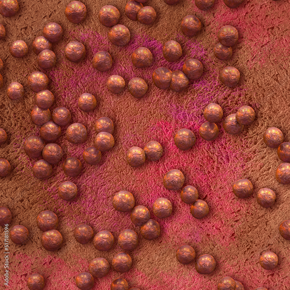 Medical background, Staphylococcus aureus, a type of spherical gram