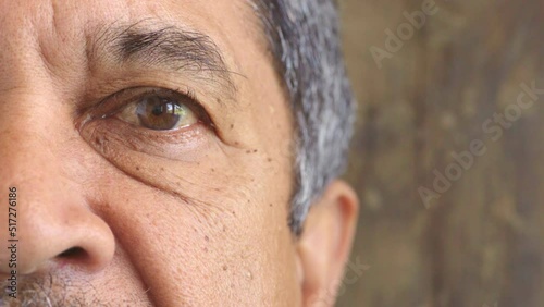 Closeup portrait of a senior mans eye at the optometrist. Side of a retired males face with zoom on his eyeball and lens. Staring and blinking at a checkup or test for infection of the conjunctiva photo
