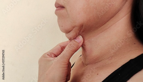Portrait showing the fingers squeezing the flabbiness adipose sagging under the neck, dullness and flabby skin, problem wrinkles and dark spots under the chin of the woman, concept health care.
