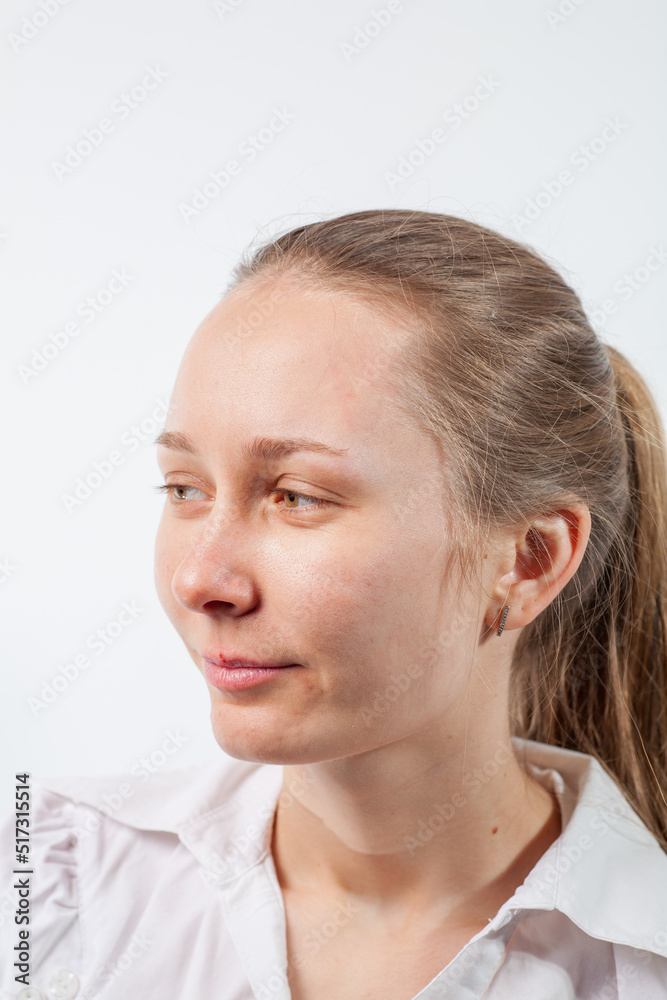 Fototapeta premium drops in the nose from a cold in a young girl