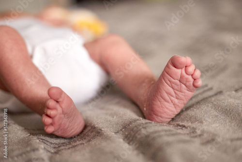 Close up photo of Newborn baby feet with flaky dry skin. Infant after born with wrinkled and cracked skin on foot