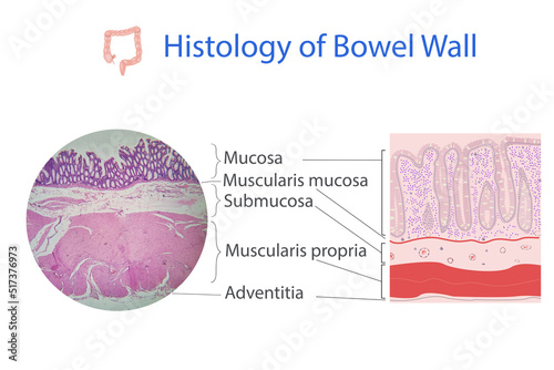 Принти на полотні histology of colon wall