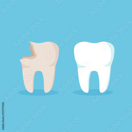 Cleaning teeth. Sick tooth. Before and after caries treatment. Dental health concept. Vector illustration isolated on blue background.