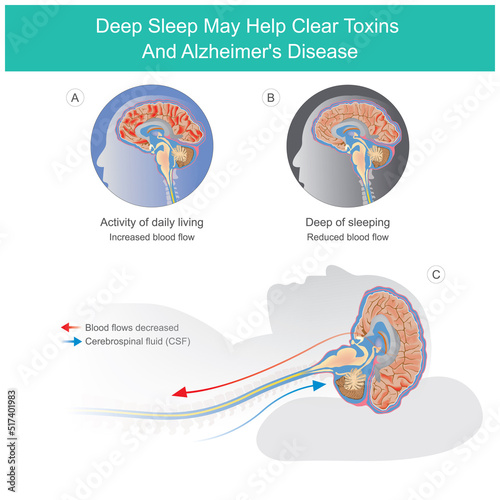 Attention deficit hyperactivity disorder. Explain ways of thinking and problem solving that happened to the brain of child..