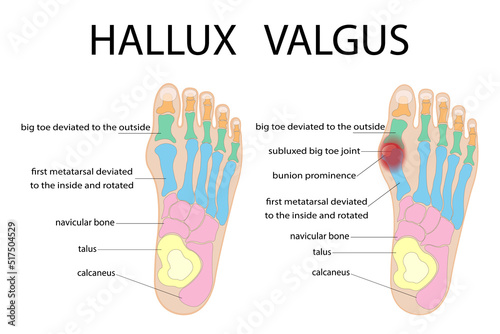 The structure of the human foot. Colorful symbols. Vector illustration.