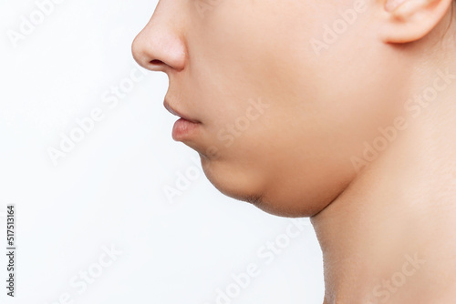 Slika na platnu Cropped shot of a young caucasian woman's face with double chin isolated on a white background