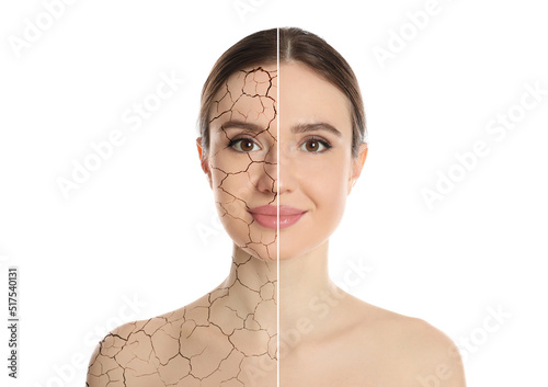 Billede på lærred Collage with photos of woman having dry skin problem before and after dry skin p