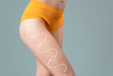 Hip liposuction, fat and cellulite removal concept, skinny female body with painted surgical lines