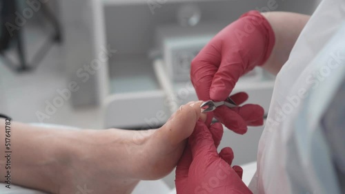 Close up of a professional medical pedicure procedure. Podologist hands with nail clippers instrument.