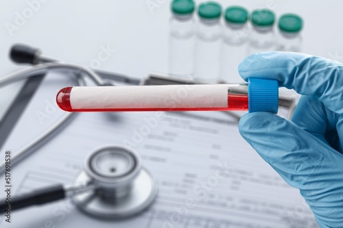 Blood sample tube for analysis Test. Blood tube test with requisition form photo