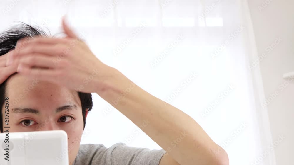 生え際を気にする男性
