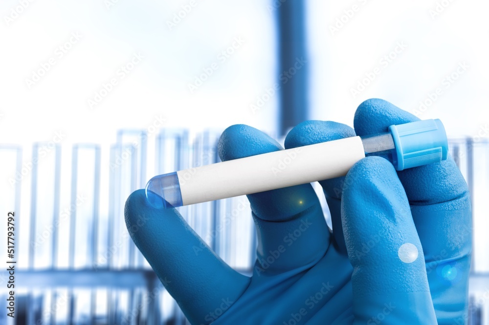 Blood tube test for test. Blood sample tube for analysis of tests in laboratory Blood tube test for test. Blood sample tube for analysis of tests in laboratory