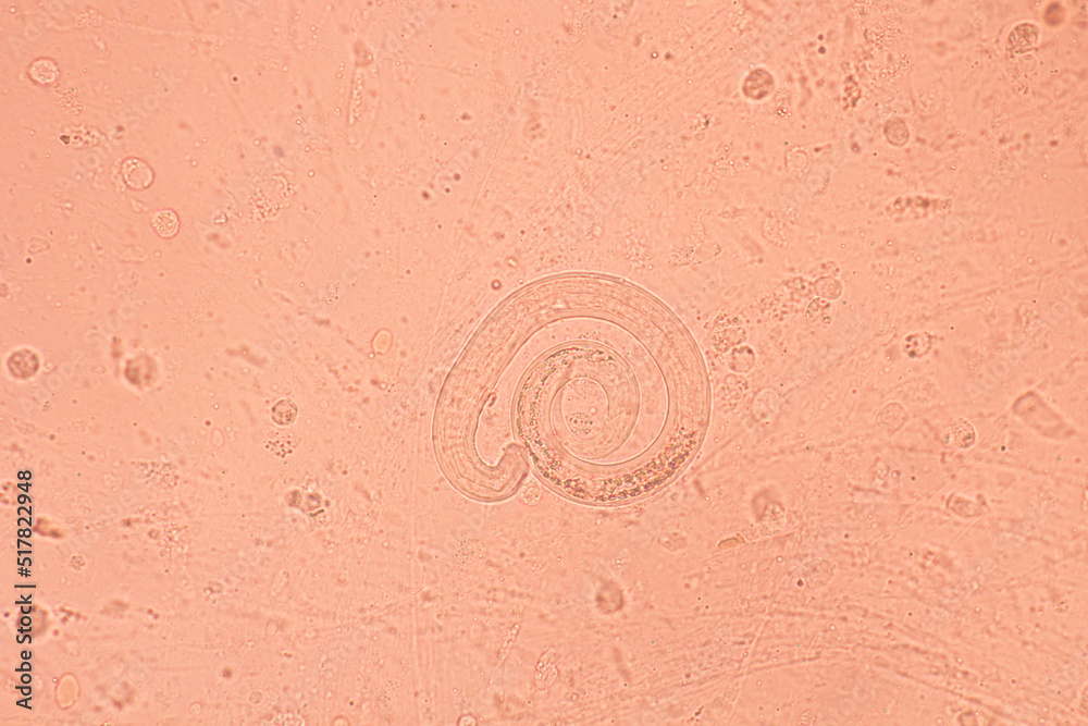 View in microscopic Strongyloides stercoralis or threadworm in human