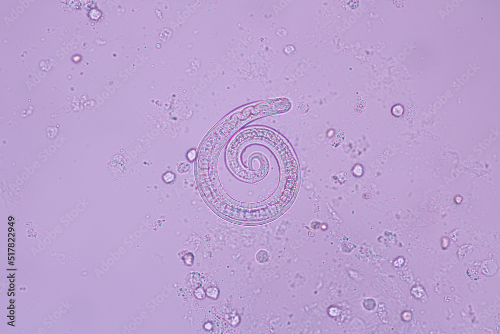 View in microscopic Strongyloides stercoralis or threadworm in human stool.Parasite infection
