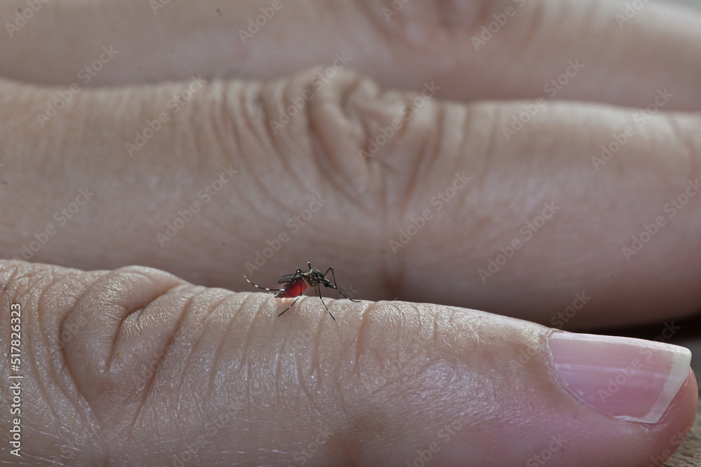 Obraz premium Striped mosquitoes are eating blood on hand skin.Mosquitoes are carriers of leishmaniasis, encephalitis, yellow fever, dengue, malaria disease, mayaro or zika virus infectious.