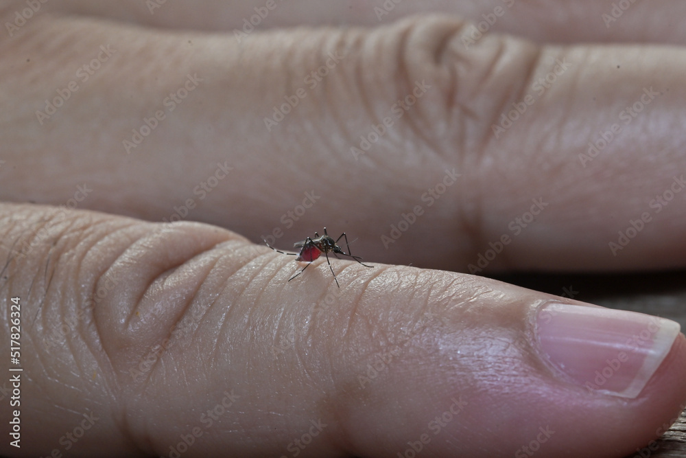 Obraz premium Striped mosquitoes are eating blood on hand skin.Mosquitoes are carriers of leishmaniasis, encephalitis, yellow fever, dengue, malaria disease, mayaro or zika virus infectious.