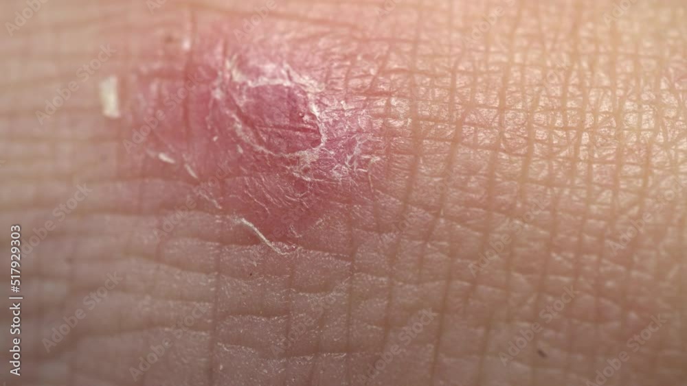 Old Wound Human Skin Slider Shot