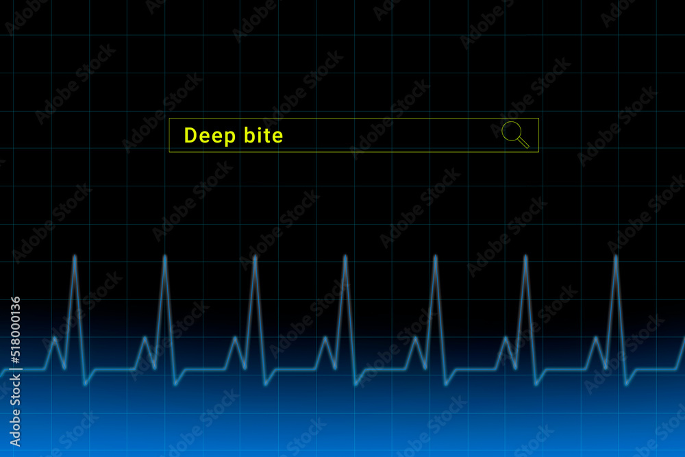 Deep bite.Deep bite inscription in search bar. Illustration with titled Deep bite . Heartbeat line as a symbol of human disease. Deep bite.Deep bite inscription in search bar. Illustration with titled Deep bite . Heartbeat line as a symbol of human disease.