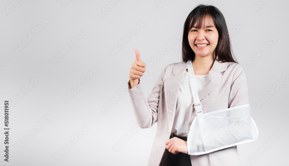 Arm broken. Business woman confident smile broken after accident wear arm splint for treatment show thumb up finger for good sign, happy Asian female sling support hand isolated on white background Arm broken. Business woman confident smile broken after accident wear arm splint for treatment show thumb up finger for good sign, happy Asian female sling support hand isolated on white background