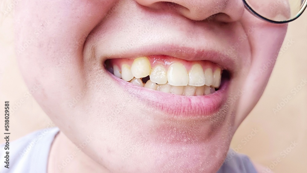 Smiling woman Smiling woman