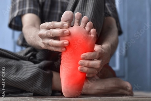Tingling and burning sensation in foot of Asian man. Foot pain. Sensory neuropathy problems. Foot nerves problems. Plantar fasciitis. © ZayNyi