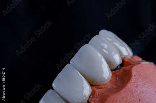 Photography laboratory prepared zirconium teeth