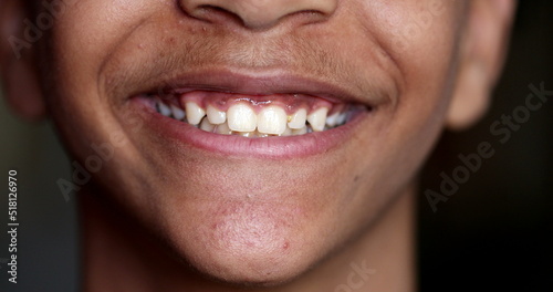 Pre-teen young boy smiling, close-up child mouth teeth