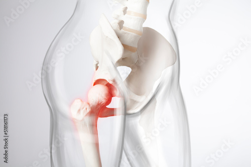 Hip bone pain photo