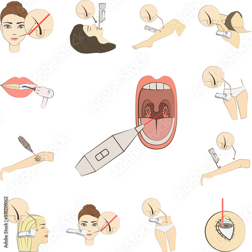 Tonsillectomy laser operation colored icon in a collection with other items