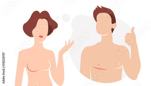 A beautiful girl is thinking about a sex change. Happy guy with a scar after a mastectomy showing thumbs up gesture. Problems of transgender women and men. The concept of determining one's gender