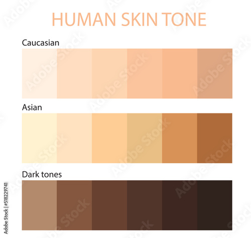 Human Skin tone color by race infographic