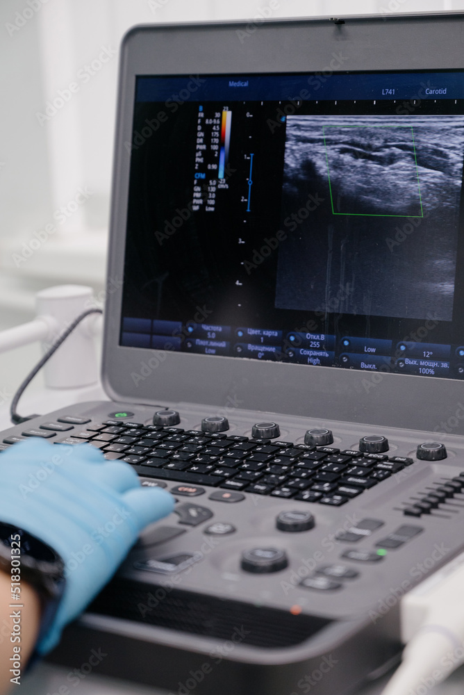 The doctor uses an ultrasound device to study the condition of the veins.Modern ultrasound monitor. The doctor uses an ultrasound device to study the condition of the veins.Modern ultrasound monitor.
