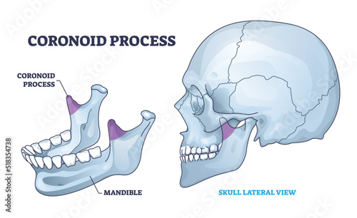 Slika na platnu Coronoid process anatomy with isolated bone and skull view outline diagram