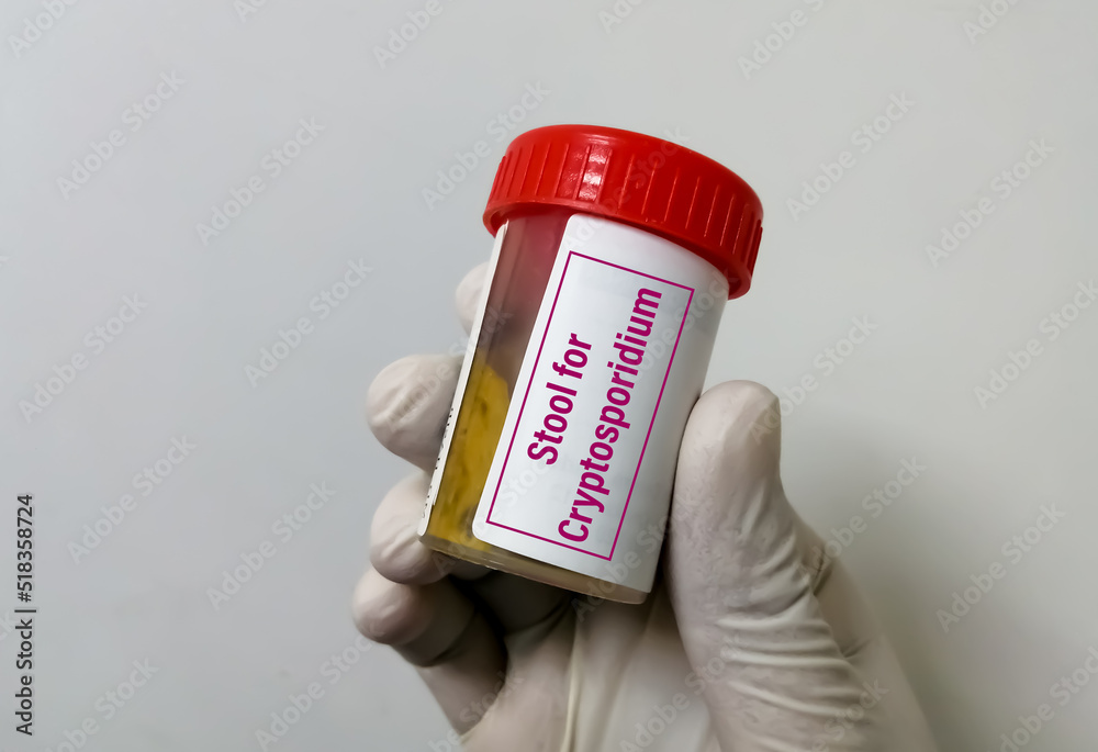 Stool sample for Cryptosporidium testing. Stock Photo Adobe Stock
