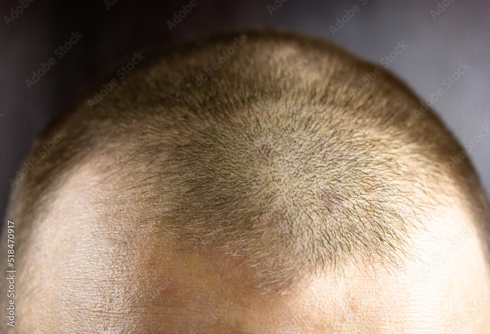 Short men's haircut close-up. Short hair on the head. Short men's haircut close-up. Short hair on the head.