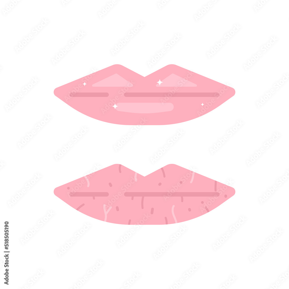 healthy lips and dry or chapped lips. lip health. health. flat cartoon