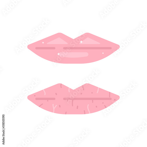 healthy lips and dry or chapped lips. lip health. health. flat cartoon illustration. vector concept design photo