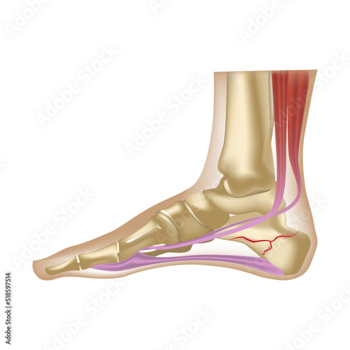 Fracture of the calcaneus. Human foot anatomy. Realistic leg drawing. Vector illustration